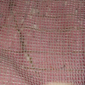 剥がれかけ多少グロ部？の画像