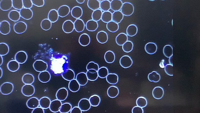 自分の血液、ミクロで観たことある⁉️の記事動画