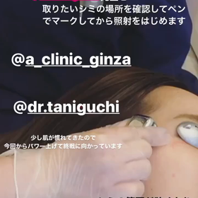 ☆しみとり☆の画像