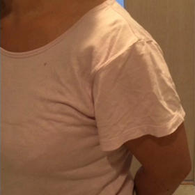 腰痛の方への画像