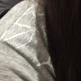 猫背の方！治し方の画像