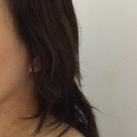 ●整形なし！自分で小顔になりたい方大募集その1の画像