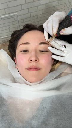 アラフォー美容事情。シミ取り・アートメイク除去&修正の経過！の記事動画