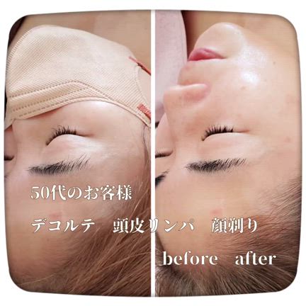 #50代のお客様 #デコルテ#頭皮リンパ #顔剃り #before afterの記事動画