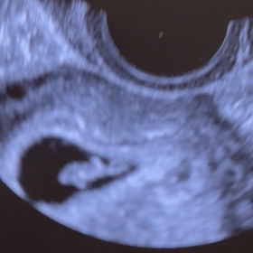 ♡6w6d...心拍確認..♡の画像