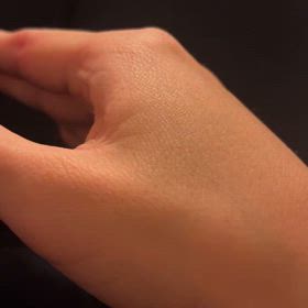 母子内転筋のピクつきの画像