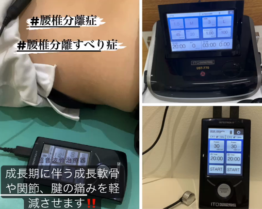 腰椎分離症は治るの？の記事動画