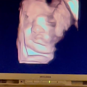 32w4d 彼似のお顔♡と、激しめな妊婦健診の料金の差。の画像