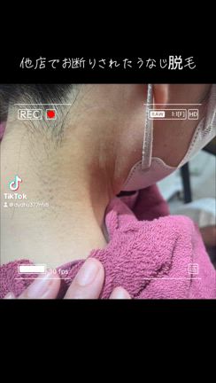 大分うなじ脱毛salon shineの記事動画