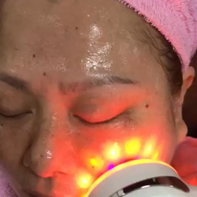 お顔の筋肉運動の画像