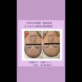 お顔が四角なる原因はの画像