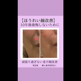 エステは内緒で行くところの画像