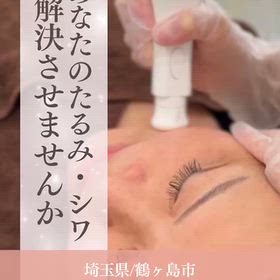しわ、たるみ改善しましょう♪の画像