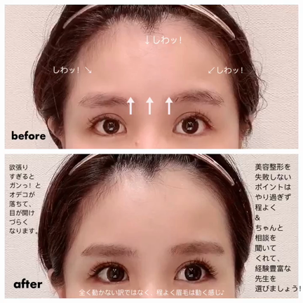 シワを作らせない方法！の記事動画
