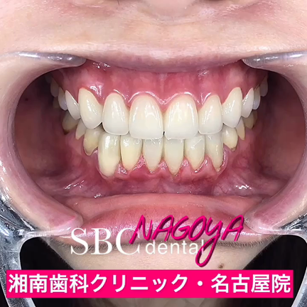 ダイヤモンドセラミック完成！！の記事動画