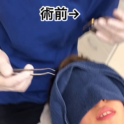 上下12本♪最高の仕上りです！の記事動画