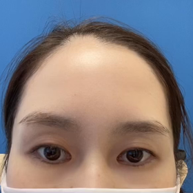ボトックスは注入されるのもするのも大好きですの画像