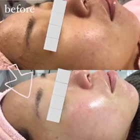 ✨肌質改善コース✨の画像