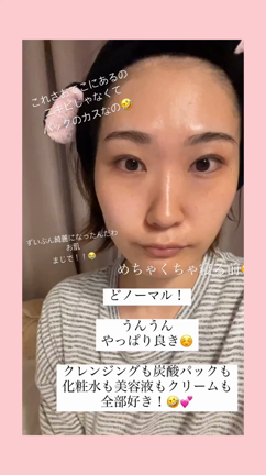 【激推し】薬用スキンクリア炭酸パック【リフトアップ】【毛穴引き締め】の記事動画