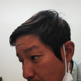 耳の画像