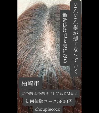 柏崎市FAGA（女性男性型脱毛症）とはの記事動画