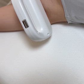 柏崎市  子ども脱毛の画像