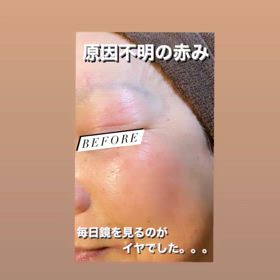 そろそろ本気でお肌と向き合ってみませんか！？の画像