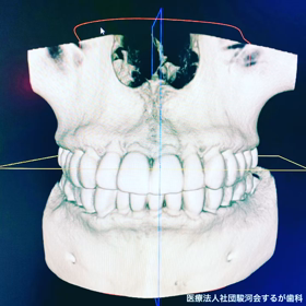 愛用のCTの画像