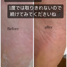 足裏角質ケアもやっていますの画像