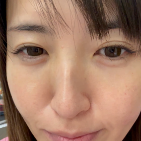 ボトックスきいてきました❤︎の画像