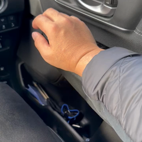 #104  現在の腕の状況は？術後１年6ヶ月経過の画像