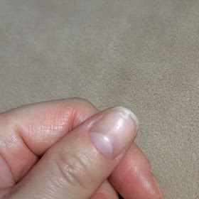 爪のケアの画像