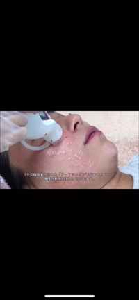 水光注射のダウンタイムについて〜大阪・心斎橋・梅田・WCLINIC〜の記事動画