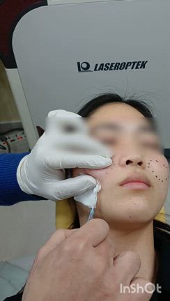 当院院長が開発！！【脂肪破壊術】施術の流れの記事動画