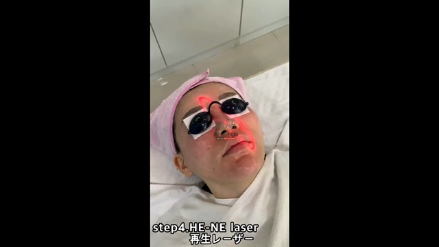《フラクセルレーザー》施術過程の記事動画