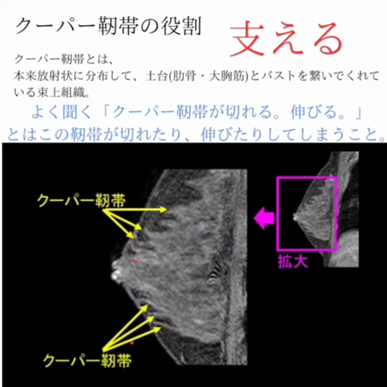 【クーパー靭帯】を強くしよう❣の記事動画