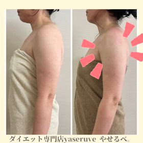 夏は二の腕痩せの画像