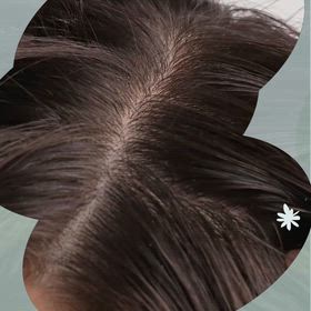 頭皮が硬くなる理由の画像
