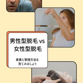 男性型脱毛と女性型脱毛の違いの画像