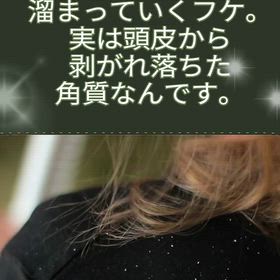 フケの対策の画像
