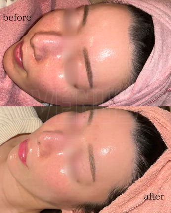 エイジレスbeautyの記事動画