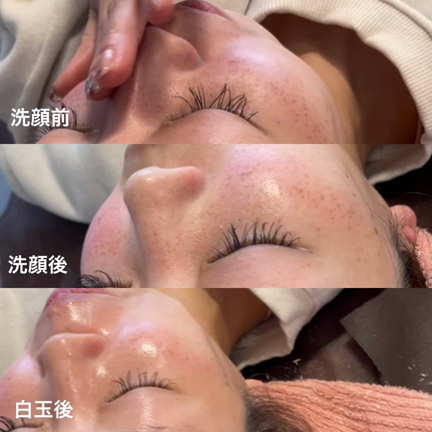 白玉スキンフェイシャル　の艶はなぜ出るか？の記事動画