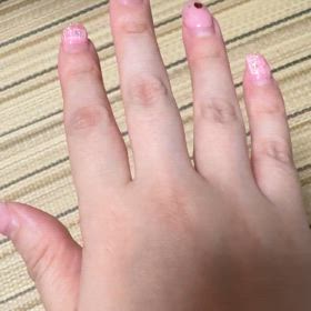 ワクチン後遺症～指の震え～の画像
