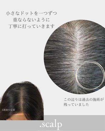 頭皮に点を描くドットスカルプの記事動画