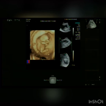 14w2d  妊婦健診の記事動画