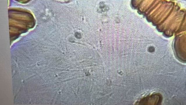ソマチッド観測の記事動画